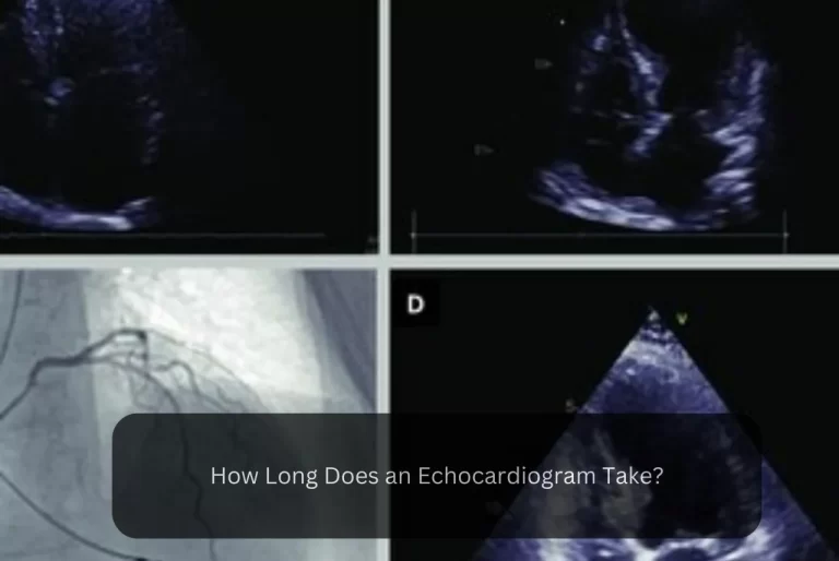 How Long Does an Echocardiogram Take?