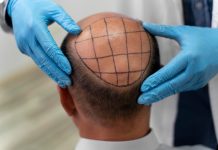 Is Your Shower Routine Damaging Your Hair? The Everyday Habits That Accelerate Thinning